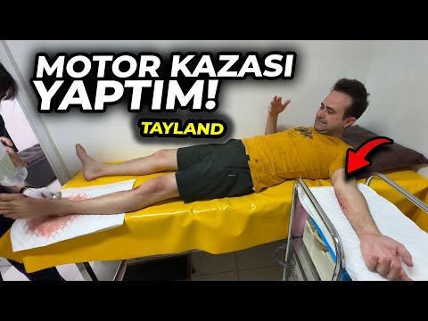 Motor Kazası Yaptım - Tayland'da Korktuğum Başıma Geldi !