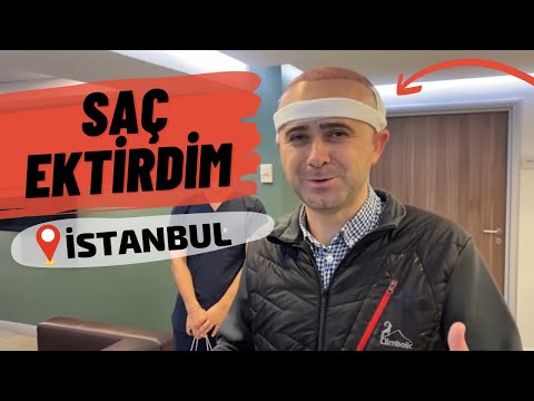 Saç Ekimi Yaptırdım - Bilmeniz Gereken Her Şey (En Kapsamlı Video)