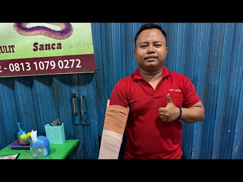 Kobra Isırmıştı! Öldü mü? Endonezya Sokak Lezzetleri