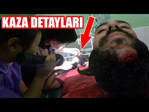 Myanmar Motor Kazası SON DURUM (Dikişlerimi Kendim Söktüm..) ~228