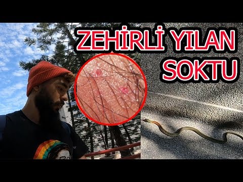 Yılan SOKTU ! Bacağıma İŞEDİM !! ~69