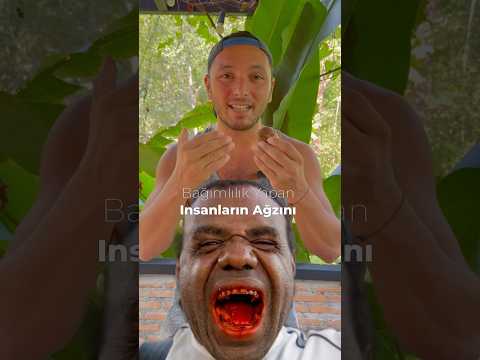 Bu Ceviz Bağımlılık Yapıyor - Betel Cevizi