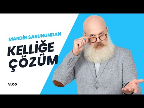 İngiliz Prensin Kelliğe Çözümü Türk Sabunundan - Mardin Vlog