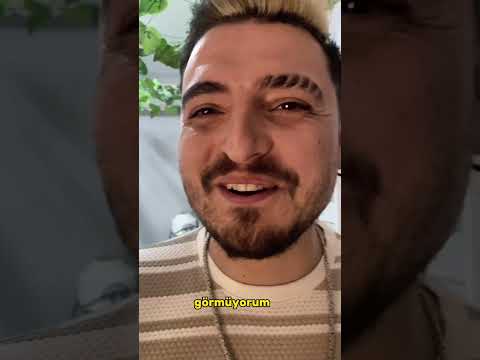 Botokstan önce alnım resmen , uhud savaşında kazılan hendekler gibiymiş aw