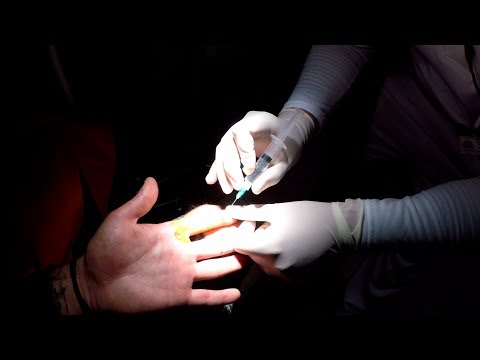 Peru'da ufak bir kaza geçirdim. #62