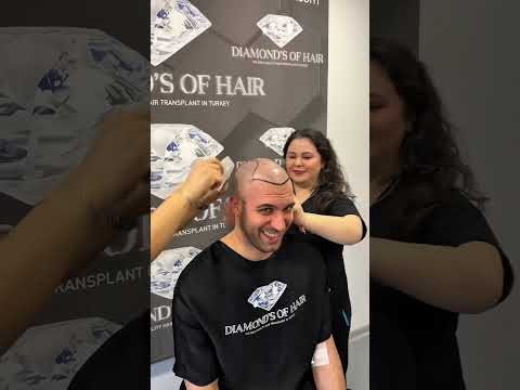 Şişko ve Kelin Değişimi 👨🏽‍🦲