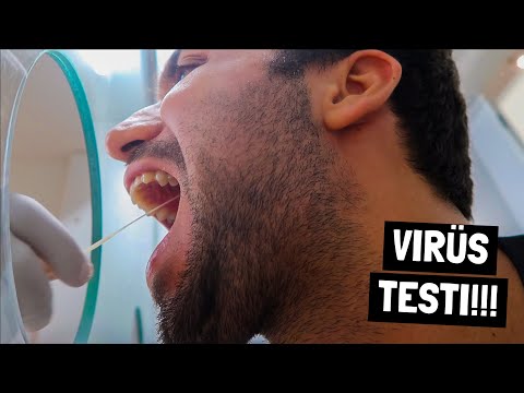 CORONA VİRÜS TESTİ YAPTIRDIM!! (Sıradaki Ülke?)